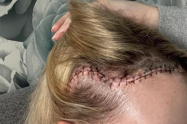 "BIO JE VELIČINE GREJPA": Otišla kod oftamologa, pa je sačekala HOROR VEST! U njoj se krila TEMPIRANA BOMBA