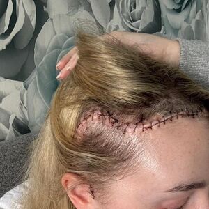 "BIO JE VELIČINE GREJPA": Otišla kod oftamologa, pa je sačekala HOROR VEST! U njoj se krila TEMPIRANA BOMBA