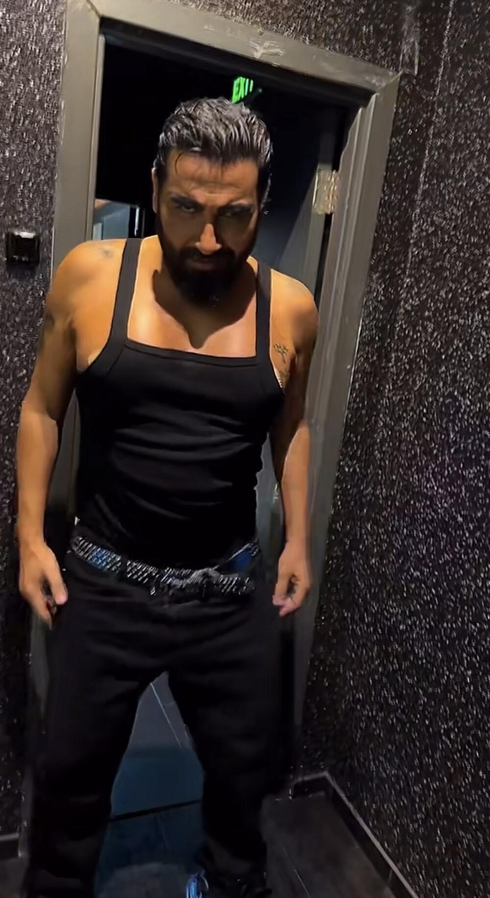 POKAZAO SILIKONE NA CECINOM NASTUPU! Azis šokirao kad je URADIO GRUDI - uporedili smo NEKAD i SAD, REZULTAT JE ŠOK