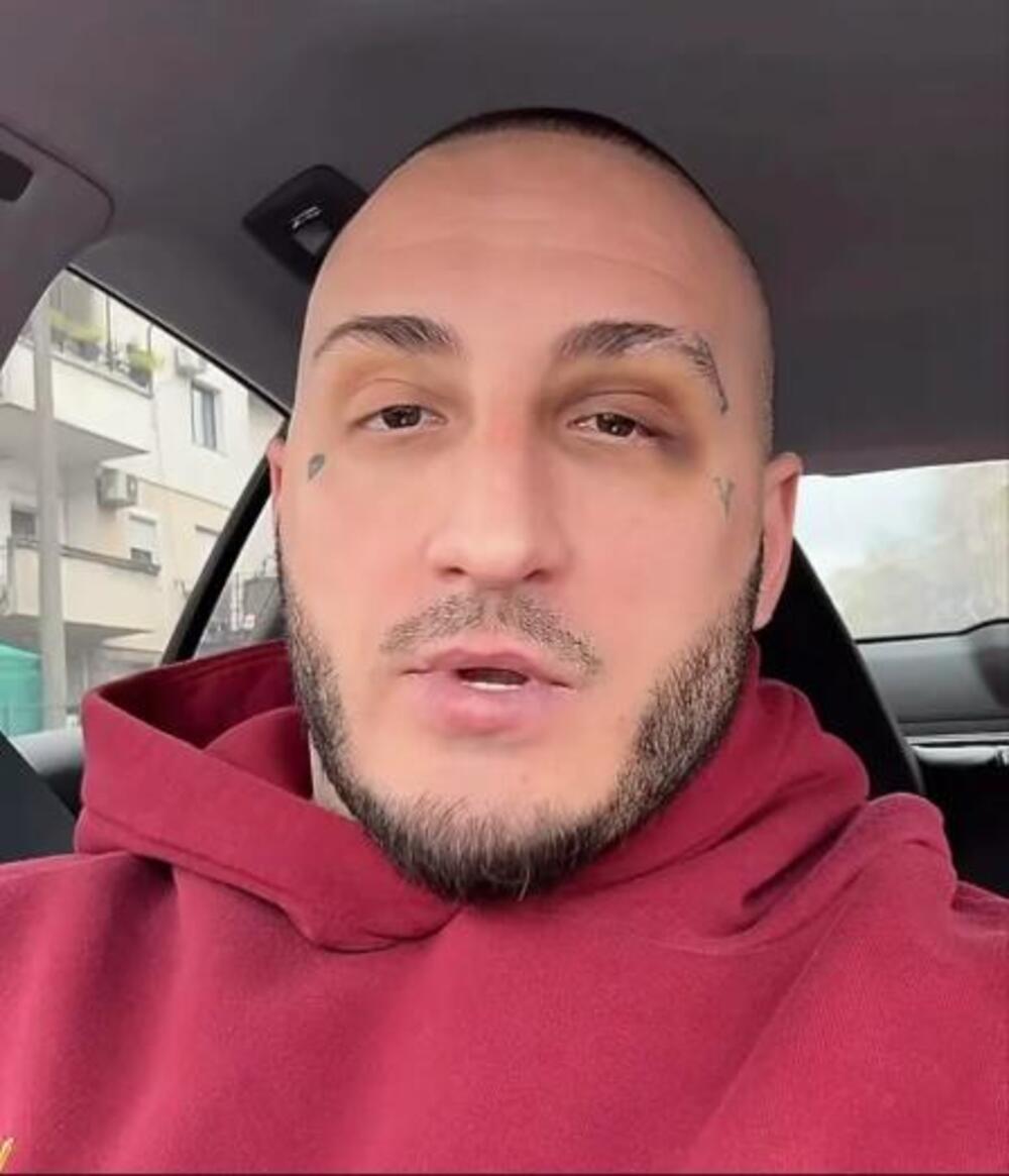 LOŠE VESTI O STANJU VUKA MOBA POSLE BRUTALNOG PREBIJANJA! Evo šta je saopštio lekar - "PUKLE SU MI OBE..."