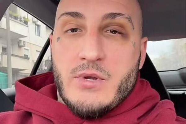 LOŠE VESTI O STANJU VUKA MOBA POSLE BRUTALNOG PREBIJANJA! Evo šta je saopštio lekar - "PUKLE SU MI OBE..."