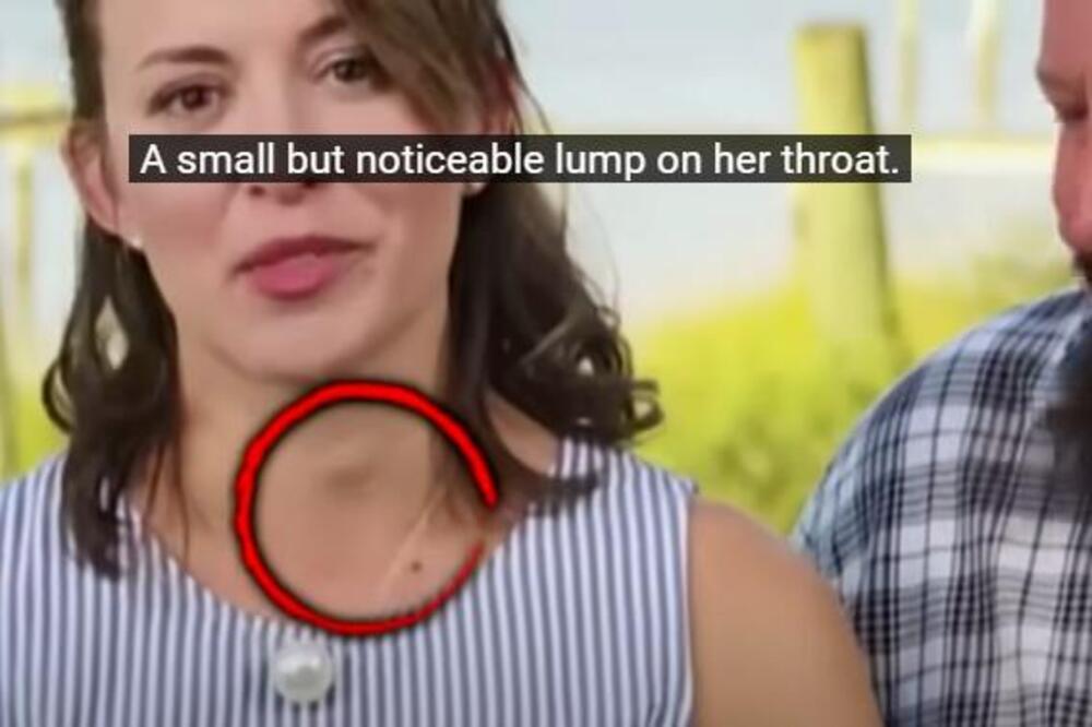 OVA ŽENA SA SLIKE JE IMALA OPASAN ZNAK RAKA GRLA, A DA NIJE ZNALA: Doktor gledao TV i odmah uočio signal! (VIDEO)