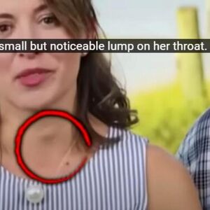 OVA ŽENA SA SLIKE JE IMALA OPASAN ZNAK RAKA GRLA, A DA NIJE ZNALA: Doktor gledao TV i odmah uočio signal! (VIDEO)