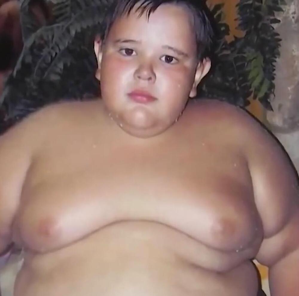 PRE 10 GODINA GA PROGLASILI NAJKRUPNIJM RUSKIM DEČAKOM! Krivicu svalili na roditelje, evo šta je DANAS S NJIM