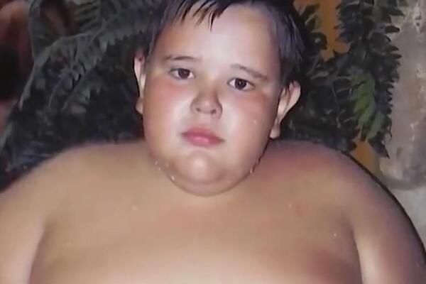 PRE 10 GODINA GA PROGLASILI NAJKRUPNIJM RUSKIM DEČAKOM! Krivicu svalili na roditelje, evo šta je DANAS S NJIM