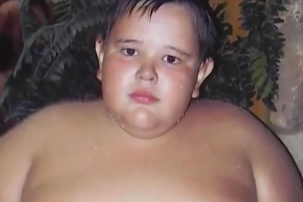 PRE 10 GODINA GA PROGLASILI NAJKRUPNIJM RUSKIM DEČAKOM! Krivicu svalili na roditelje, evo šta je DANAS S NJIM