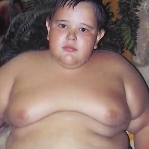 PRE 10 GODINA GA PROGLASILI NAJKRUPNIJM RUSKIM DEČAKOM! Krivicu svalili na roditelje, evo šta je DANAS S NJIM