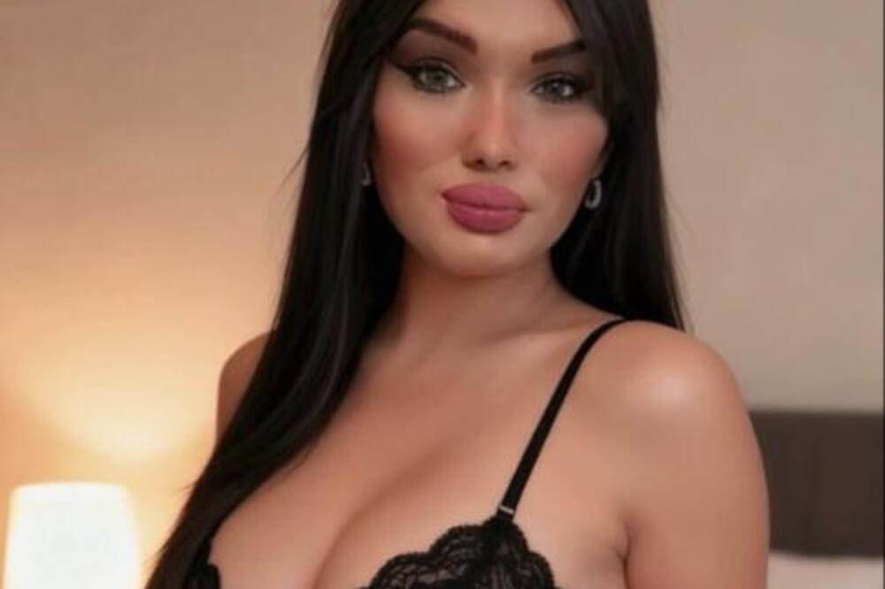 DA LI BISTE IKAD REKLI DA JE BILA MUŠKO? Operisala pol, pa se svukla u MINIĆ! Ljudi kliču PLASTIČNOM HIRURGU