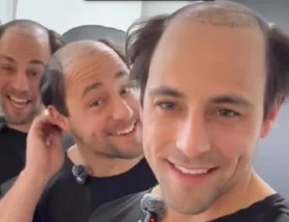 "KAD SAM VIDEO GROBLJE NA SVOJOJ GLAVI..." Braća otišla na TRANSPLANTACIJU KOSE U TURSKU: "MORALI SMO DA REAGUJEMO"