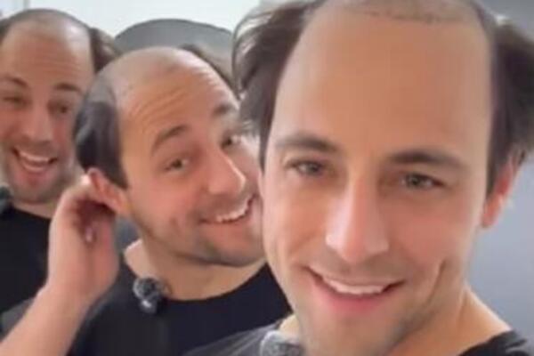 "KAD SAM VIDEO GROBLJE NA SVOJOJ GLAVI..." Braća otišla na TRANSPLANTACIJU KOSE U TURSKU: "MORALI SMO DA REAGUJEMO"