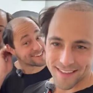 "KAD SAM VIDEO GROBLJE NA SVOJOJ GLAVI..." Braća otišla na TRANSPLANTACIJU KOSE U TURSKU: "MORALI SMO DA REAGUJEMO"