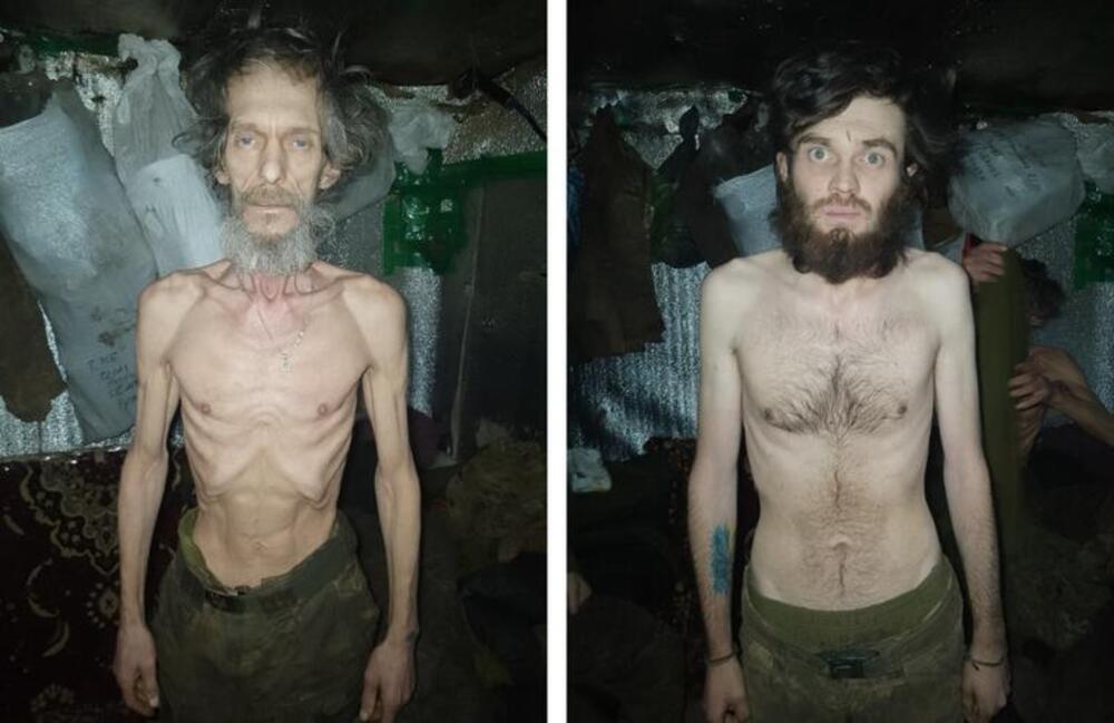 PROCURILE JEZIVE FOTOGRAFIJE UKRAJINSKIH VOJNIKA! Od prizora će vam se OKRENUTI ŽELUDAC - sama KOST I KOŽA (FOTO)