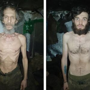 PROCURILE JEZIVE FOTOGRAFIJE UKRAJINSKIH VOJNIKA! Od prizora će vam se OKRENUTI ŽELUDAC - sama KOST I KOŽA (FOTO)