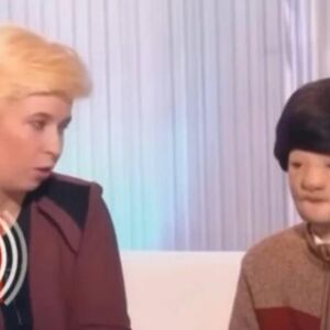 IGORA JE MAJKA OSTAVILA SA STAFORDOM, KAD GA JE PAS BRUTALNO NAPAO: Pola lica mu je unakaženo, jedva preživeo napad