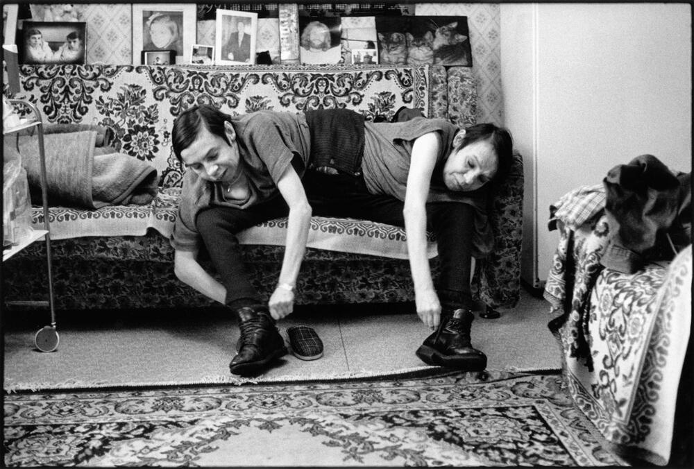 MAŠA I DAŠA SE RODILE U ISTOM TELU SA DVE GLAVE: Majka završila u ludnici, a na njima izvodili UŽASNE EKSPERIMENTE!