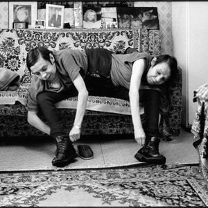 MAŠA I DAŠA SE RODILE U ISTOM TELU SA DVE GLAVE: Majka završila u ludnici, a na njima izvodili UŽASNE EKSPERIMENTE!