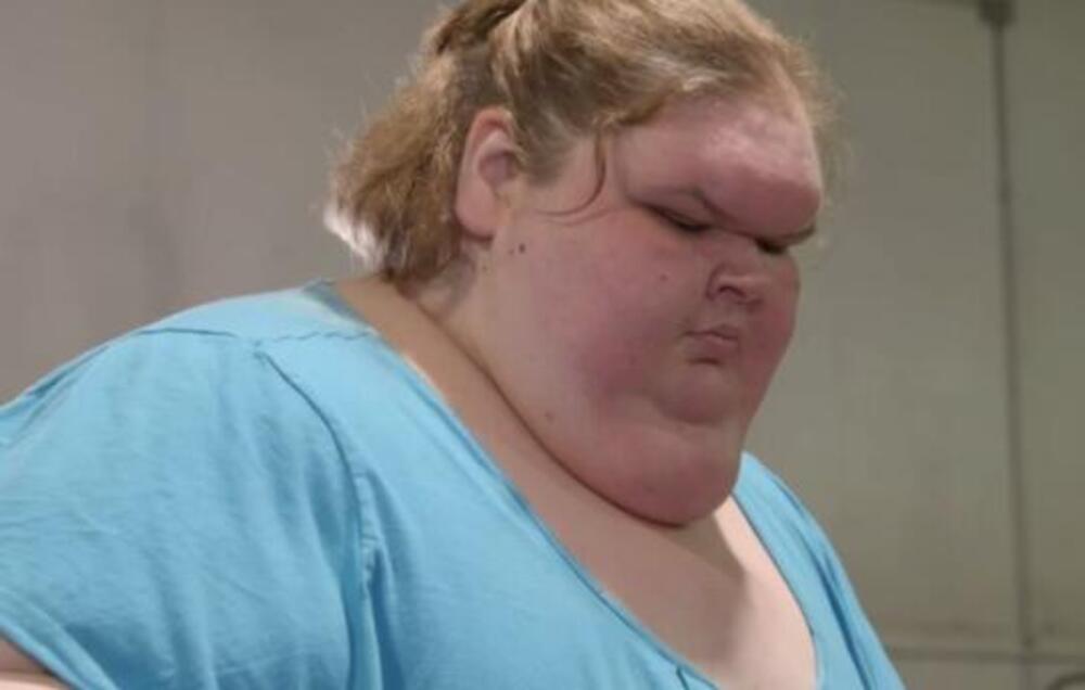 SMRŠALA JE 200 KILOGRAMA, A ONDA SKINULA 100 KILOGRAMA KOŽE: Danas izgleda neprepoznatljivo, svi su U ŠOKU (FOTO)