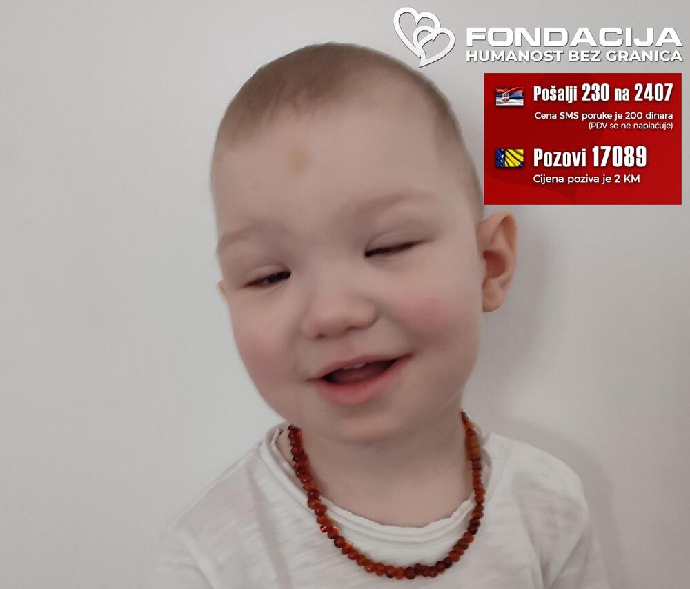 Maleni Loris ima retko genetsko oboljenje: Lečenje je preskupo, treba mu naša pomoć! (FOTO)