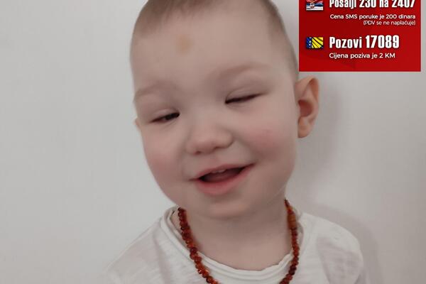 Maleni Loris ima retko genetsko oboljenje: Lečenje je preskupo, treba mu naša pomoć! (FOTO)