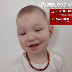 Maleni Loris ima retko genetsko oboljenje: Lečenje je preskupo, treba mu naša pomoć! (FOTO)