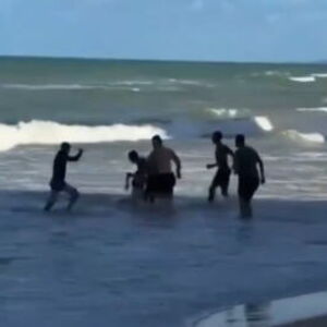 AJKULA ODGRIZLA DEVOJCI NOGU USRED PLIĆAKA, krici odjeknuli plažom! Samo dan ranije DEČAK OSTAO BEZ EKSTREMITETA!