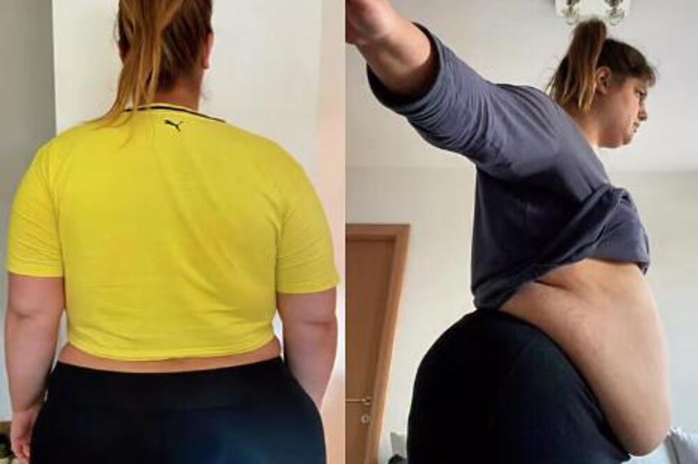 MILICU JE VERENIK OSTAVIO KADA JE IMALA 136 KILOGRAMA: Sada nema zgodnije od nje u celom Novom Sadu (FOTO)