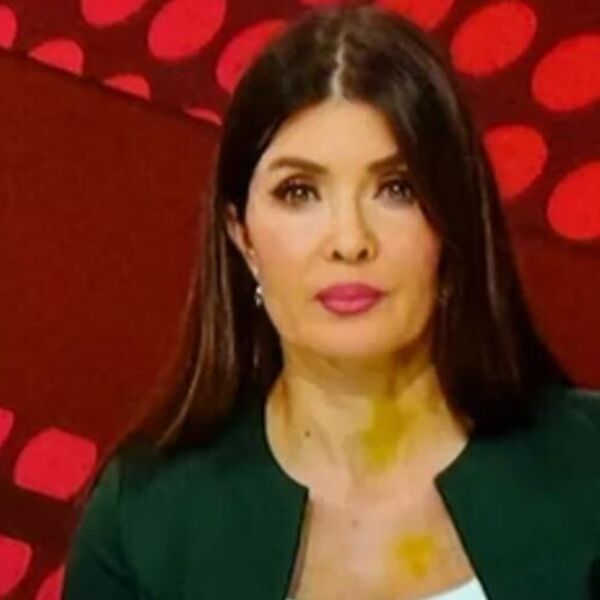 Cela Srbija brujala je o žutim mrljama na vratu voditeljke RTS-a: Svi mislili da su modrice, sad isplivala istina