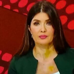 Cela Srbija brujala je o žutim mrljama na vratu voditeljke RTS-a: Svi mislili da su modrice, sad isplivala istina
