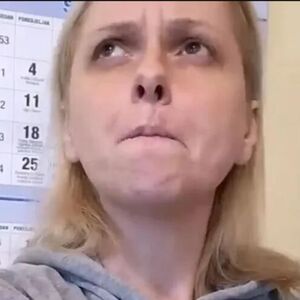 PRIMETILA BUBULJICU NA USNI, PA SAZNALA DA IMA RAK! Lekari joj ODSTRANILI DEO LICA, a nakon 5. operacije...