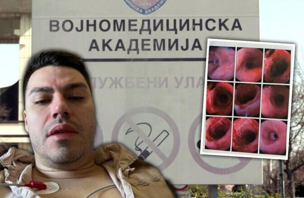 Aleksandru su u kladionici u Beogradu umesto kisele vode doneli sonu kiselinu: Jedva izvukao živu glavu