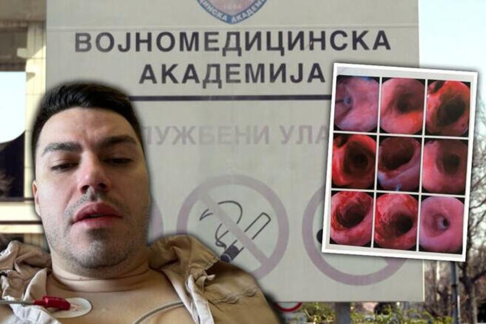 Aleksandru su u kladionici u Beogradu umesto kisele vode doneli sonu kiselinu: Jedva izvukao živu glavu