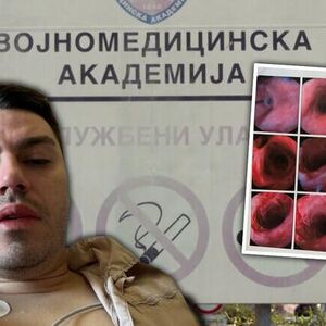 Aleksandru su u kladionici u Beogradu umesto kisele vode doneli sonu kiselinu: Jedva izvukao živu glavu