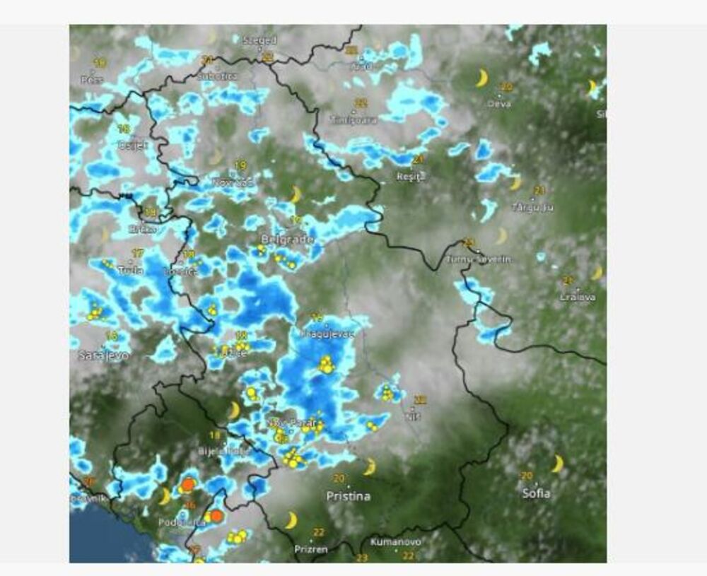 Radar