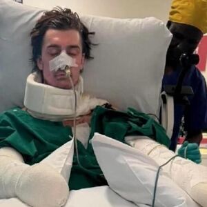 LAKIJU EKSPLODIRAO ROBOT USISIVAČ U KUHINJI: Krenuo da sprema doručak, pa završio u komi - JEDVA PREŽIVEO (FOTO)
