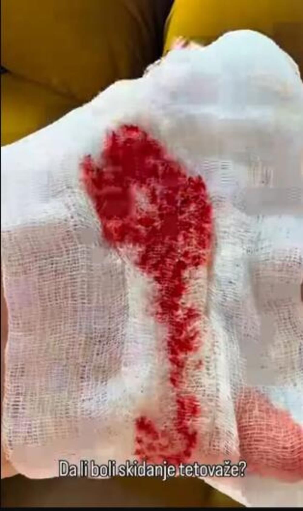 VODITELJKA PINKA LEŽI U KRVI! Od prevelikih bolova JAUČE I KUKA! Snimak nije za slabiće!