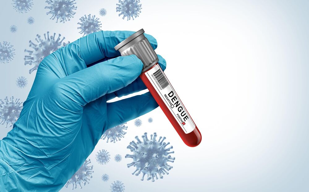 Virus Zapadnog Nila