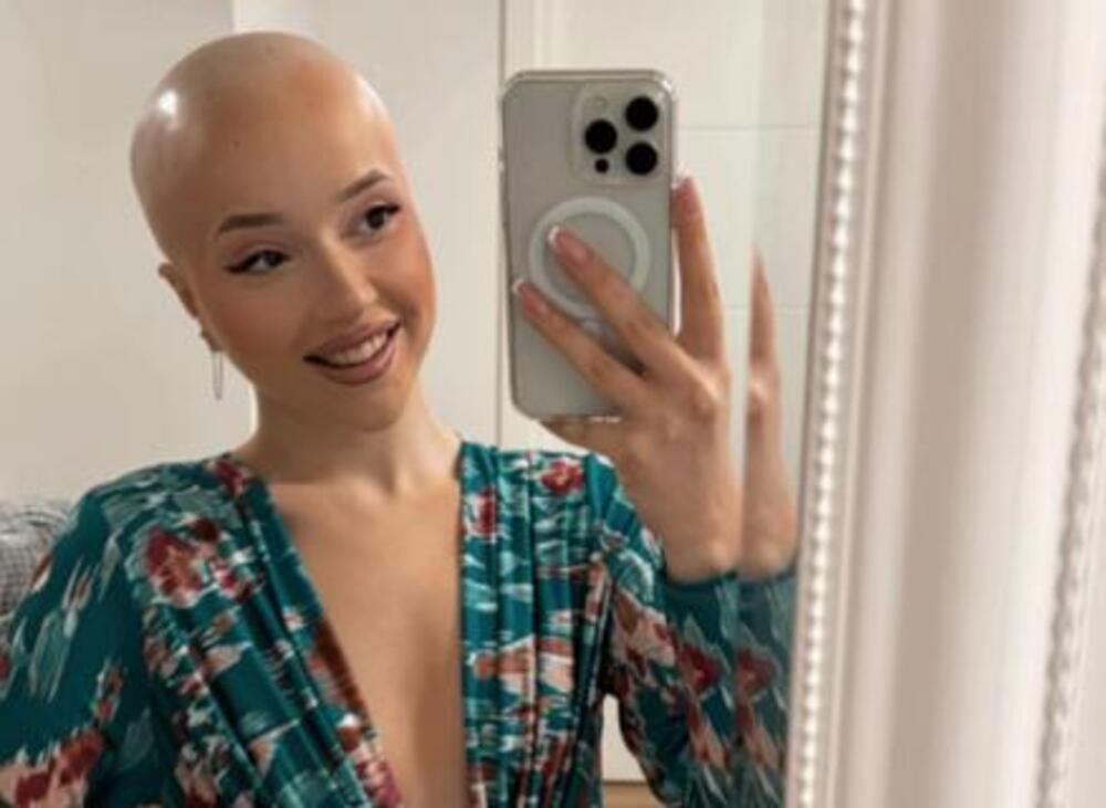 "GLEDAJ, ĆELAVA, UBIĆE JE RAK!" Emilia iz Pančeva je sa 20 godina dobila STRAŠNU DIJAGNOZU, danas je jača nego ikad