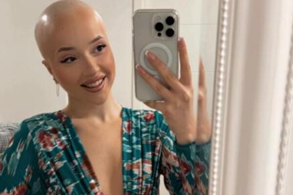"GLEDAJ, ĆELAVA, UBIĆE JE RAK!" Emilia iz Pančeva je sa 20 godina dobila STRAŠNU DIJAGNOZU, danas je jača nego ikad