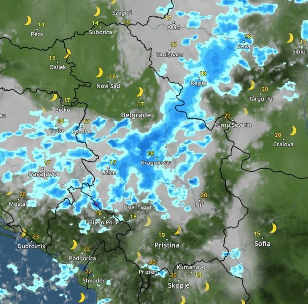 Radar