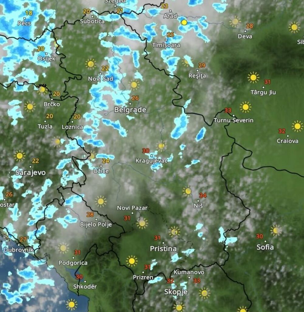Radar
