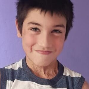 Nikolu je majka polila kiselinom pa je sa njim skočila sa trećeg sprata: Ostale su brojne posledice, pomozimo!