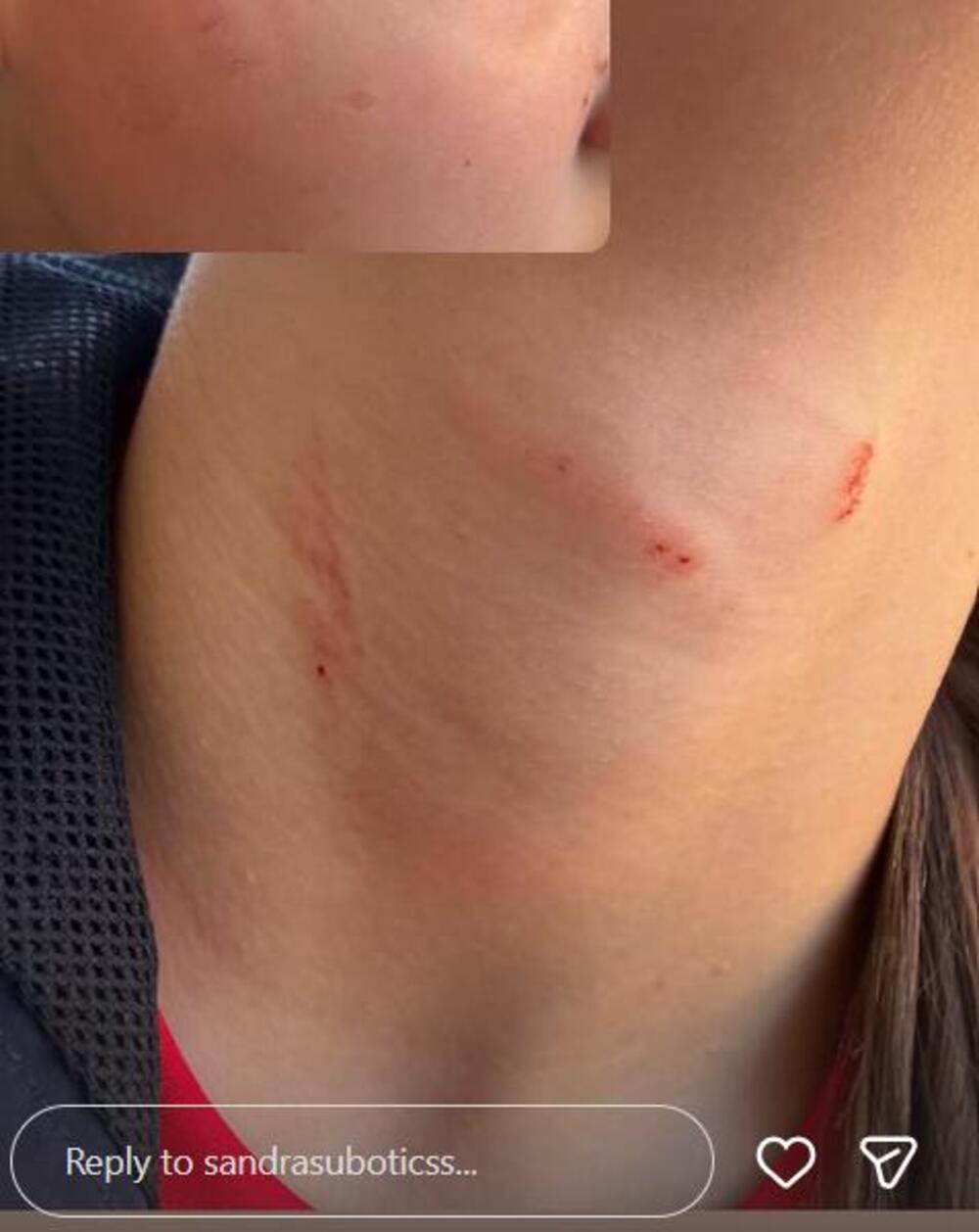"KAO MAJKA SAM ZGRANUTA" Aleksandra Subotić objavila potresne slike ćerke, tvrdi da je dete pretrpelo nasilje
