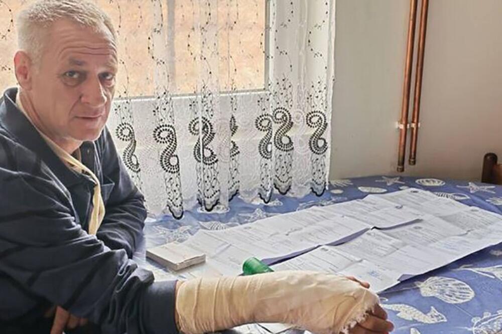 "DOĐI VAMO DA TI OTKINEM GLAVU"! Muškarac (51) teško povređen nakon svađe u saobraćaju, ovaj ga napao "VILAMA"