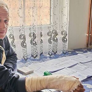 "DOĐI VAMO DA TI OTKINEM GLAVU"! Muškarac (51) teško povređen nakon svađe u saobraćaju, ovaj ga napao "VILAMA"