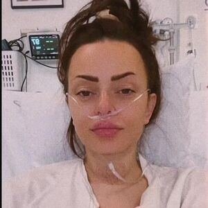 IMALA RAK KOSTIJU I ŠTITNE, SAD OPERISALA TUMOR NA GLAVI! Prve slike posle operacije RIJALITI UČESNICE "Jako boli"