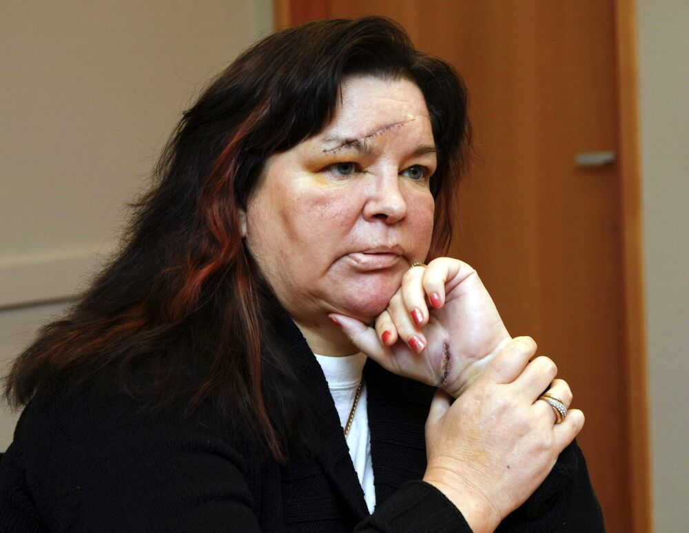 Mervi Tapole