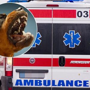 Ćerka povređene žene za Kurir otkrila detalje napada pasa na Voždovcu, drama trajala 40 minuta